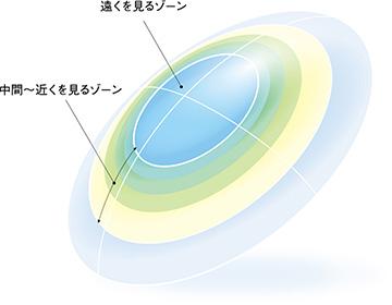 マルチフォーカルO2ノア